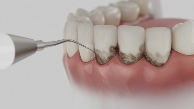 Reliable Emergency Dentist contractor in Barre, VT by Smile Center Dentistry